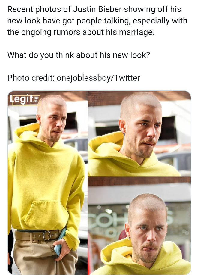 Justin Bieber’s New Look Sparks Concern Among Fans